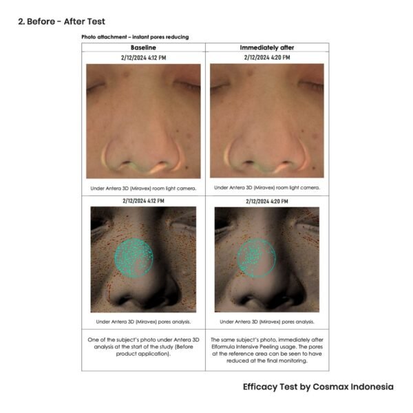 ELFORMULA Intensive Peeling Solution – Serum